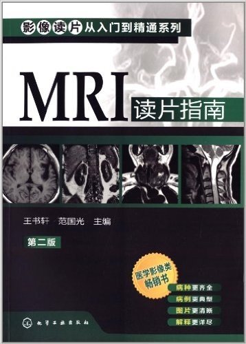 影像读片从入门到精通系列:MRI读片指南(第2版)