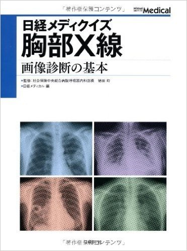 日経メディクイズ 胸部X線 画像診断の基本
