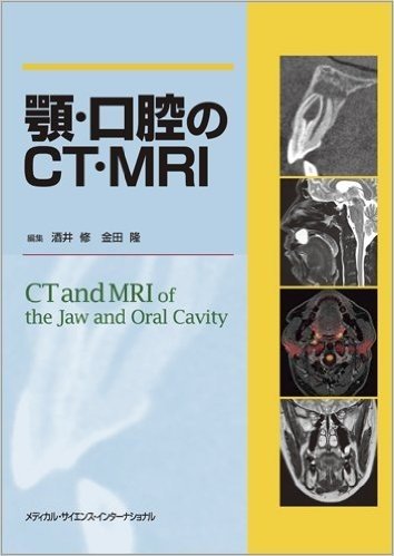 顎・口腔のCT・MRI