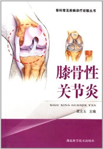 骨科常见疾病诊疗经验丛书:膝骨性关节炎