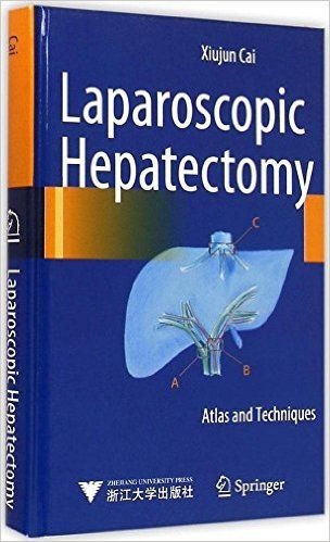 Laparoscopic Hepatectomy:Atlas and Techniques腹腔镜肝切除术(图谱和技术)(精装全彩印刷)(附DVD光盘2张)