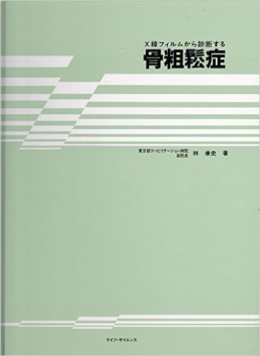 X線フィルムから診断する骨粗鬆症