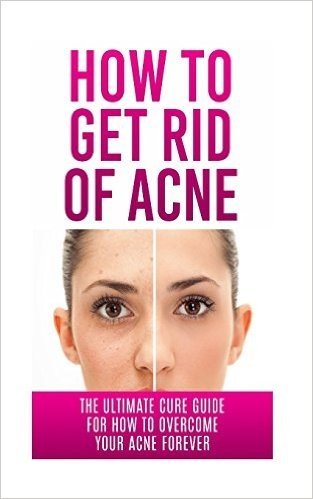 How to Get Rid of Acne: The Ultimate Cure Guide for How to Overcome Your Acne Forever
