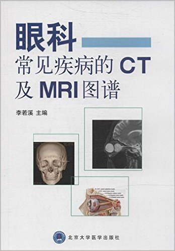 眼科常见疾病的CT及MRI图谱