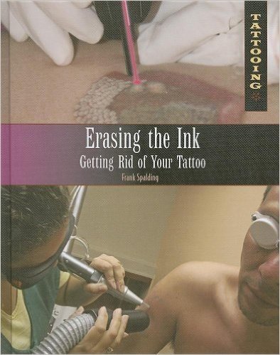 Erasing the Ink: Getting Rid of Your Tattoo