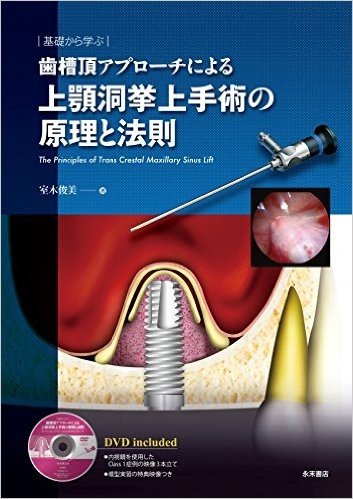 基礎から学ぶ 歯槽頂アプローチによる上顎洞挙上手術の原理と法則 The Principles of Trans Crestal Maxillary Sinus Lift