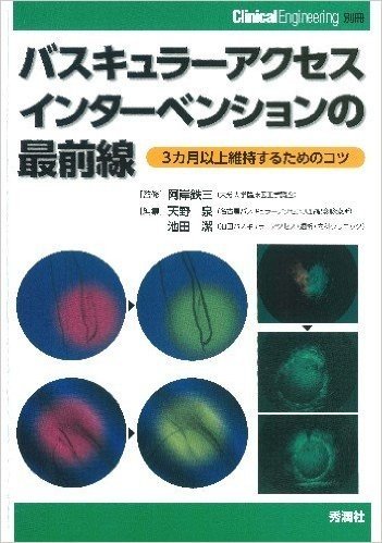 バスキュラーアクセスインターベンションの最前線 3カ月以上維持するためのコツ