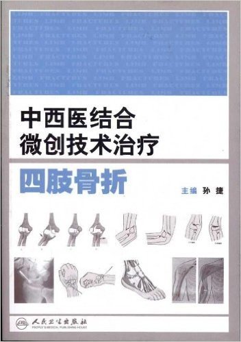 中西医结合微创技术治疗四肢骨折