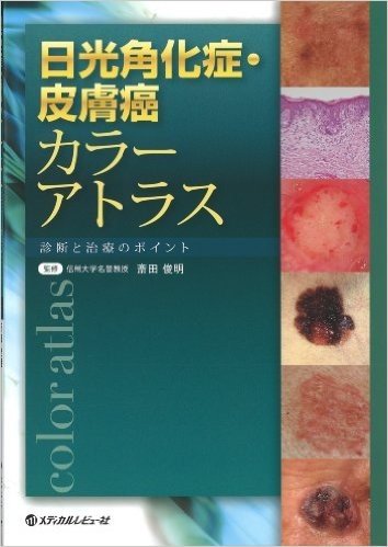 日光角化症·皮膚癌カラーアトラス:診断と治療のポイント