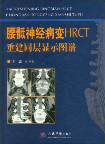 腰骶神经病变HRCT重建同层显示图谱