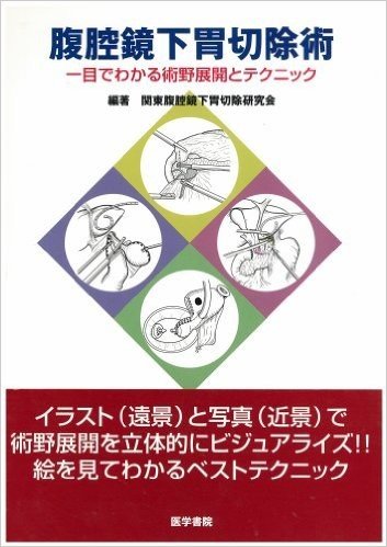 腹腔鏡下胃切除術 一目でわかる術野展開とテクニック