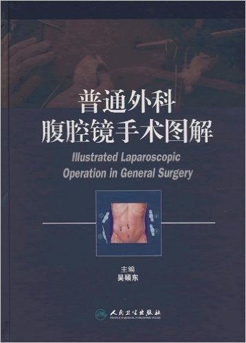 普通外科腹腔镜手术图解
