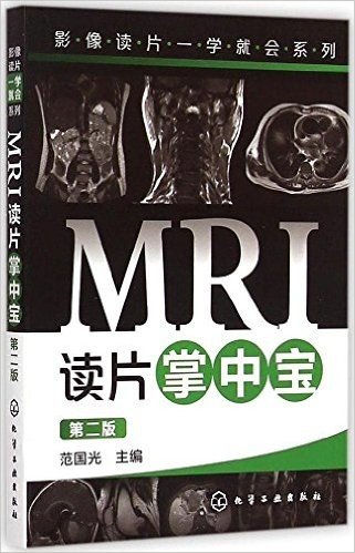 MRI读片掌中宝(第二版)