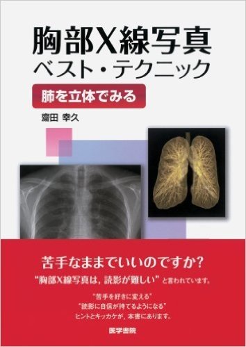 胸部X線写真ベスト·テクニック:肺を立体でみる