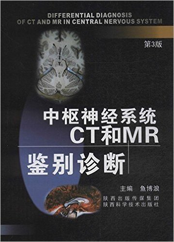 中枢神经系统CT和MR鉴别诊断(第3版)