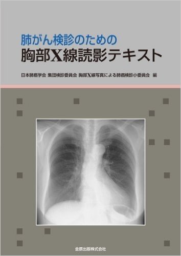 肺がん検診のための胸部X線読影テキスト