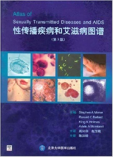 性传播疾病和艾滋病图谱(第3版)