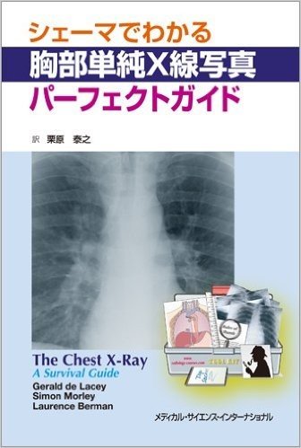 シェーマでわかる胸部単純X線写真パーフェクトガイド