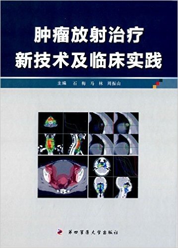 肿瘤放射治疗新技术及临床实践