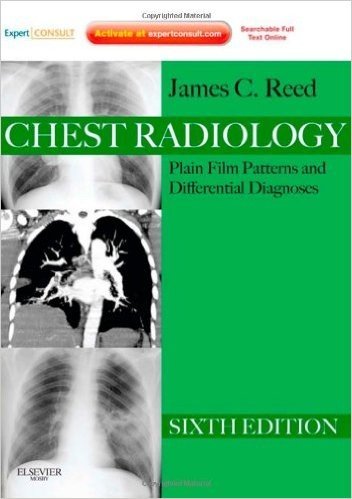 Chest Radiology: Plain Film Patterns and Differential Diagnoses, Expert Consult - Online and Print