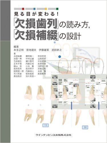 見る目が変わる!  "欠損歯列"の読み方,"欠損補綴"の設計