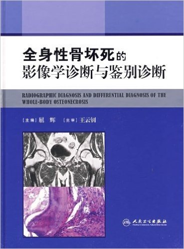 全身性骨坏死的影像学诊断与鉴别诊断