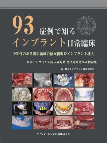 93症例で知るインプラント日常臨床 予知性のある審美領域の抜歯後即時インプラント埋入 日本インプラント臨床研究会全員発表会3rd抄録集