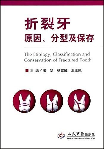 折裂牙原因、分型及保存