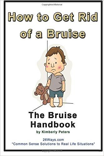 How to Get Rid of a Bruise: The Bruise Handbook