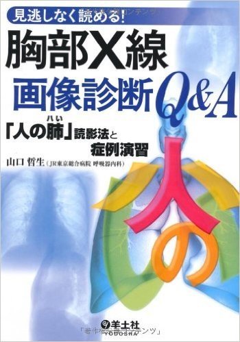 見逃しなく読める!胸部X線画像診断Q&A:"人の肺"読影法と症例演習