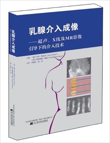 乳腺介入成像:超声、X线及MR影像引导下的介入技术