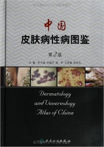 中国皮肤病性病图鉴(第2版)
