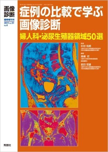 症例の比較で学ぶ画像診断 婦人科・泌尿生殖器領域50選