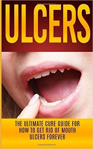 Ulcers: The Ultimate Cure Guide for How to Get Rid of Mouth Ulcers Instantly