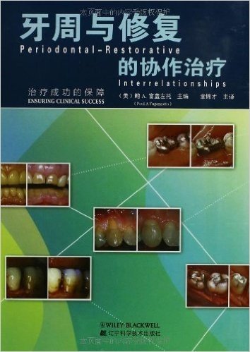 牙周与修复的协作治疗
