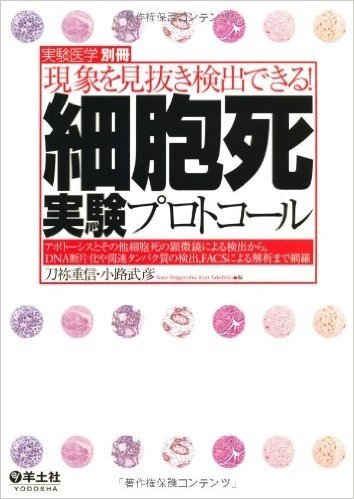 現象を見抜き検出できる!細胞死実験プロトコール アポトーシスとその他細胞死の顕微鏡による検出から,DNA断片化や関連タンパク質の検出,FACSによる解析まで網羅