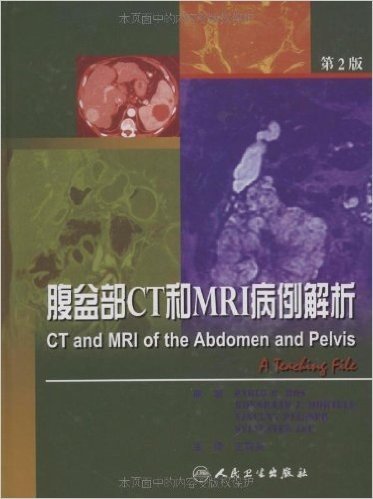 腹盆部CT和MRI病例解析