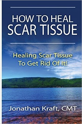 How to Heal Scar Tissue: How to Heal Your Own Scar Tissue and Get Rid of It!