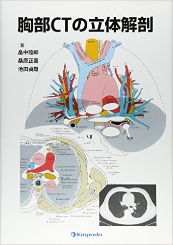 胸部CTの立体解剖