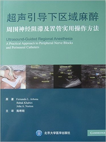 【出版社自营】超声引导下区域麻醉：周围神经阻滞及置管实用操作方法