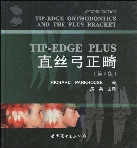 TIP-EDGE PLUS直丝弓正畸(精)(第2版)