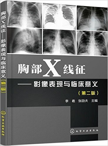 胸部X线征:影像表现与临床意义(第二版)