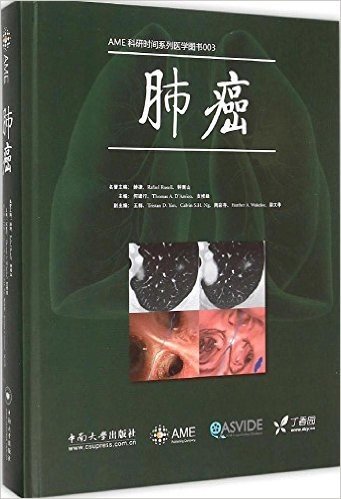 AME科研时间系列·医学图书003:肺癌