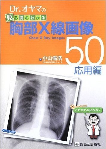 Dr.オヤマの見る読むわかる胸部X線画像50 応用編