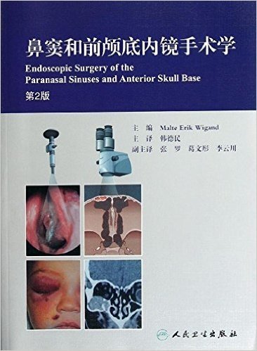 鼻窦和前颅底内镜手术学(第2版)(翻译版)