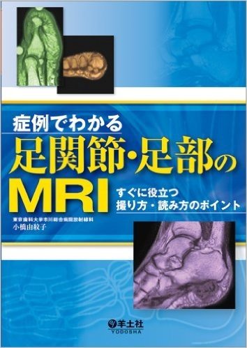症例でわかる足関節·足部のMRI〜すぐに役立つ撮り方·読み方のポイント