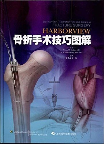 Harborview骨折手术技巧图解