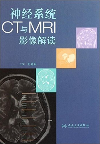 神经系统CT与MRI影像解读