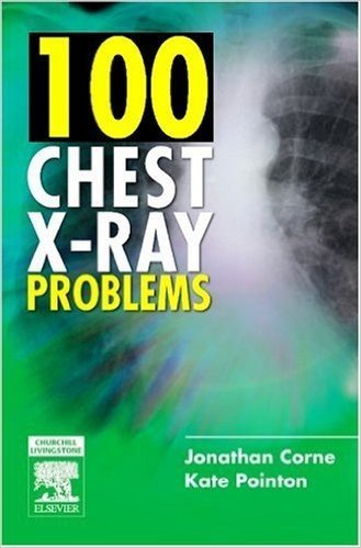 100 Chest X-Ray Problems