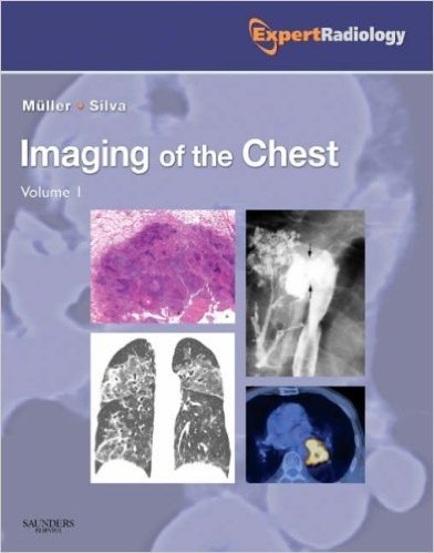 Imaging of the Chest, 2-Volume Set: Expert Radiology Series
